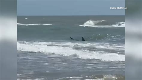 Man suffers severe shark bite on South Padre Island during July .